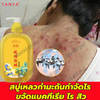 TANYA สบู่เหลวกำมะถันกำจัดไร ครีมอาบน้ำหอมๆ408ml ลบสิวควบคุมน้ำมัน ปรับสี ขจัดกลิ่นเหงื่อ ชะล้างรูขุมขน พร้อมฟื้นบำรุงผิว สบู่สมุนไพรธรรมชาติ ครีมอาบน้ำขาว เจลอาบน้ำกลิ่นหอม สบู่ สบู่เหลว ครีมอาบน้ำ ครีมอาบน้ำเด็กสบู่เหลว ครีมอาบน้ำหอม สบู่อาบน้ำขจัดไร