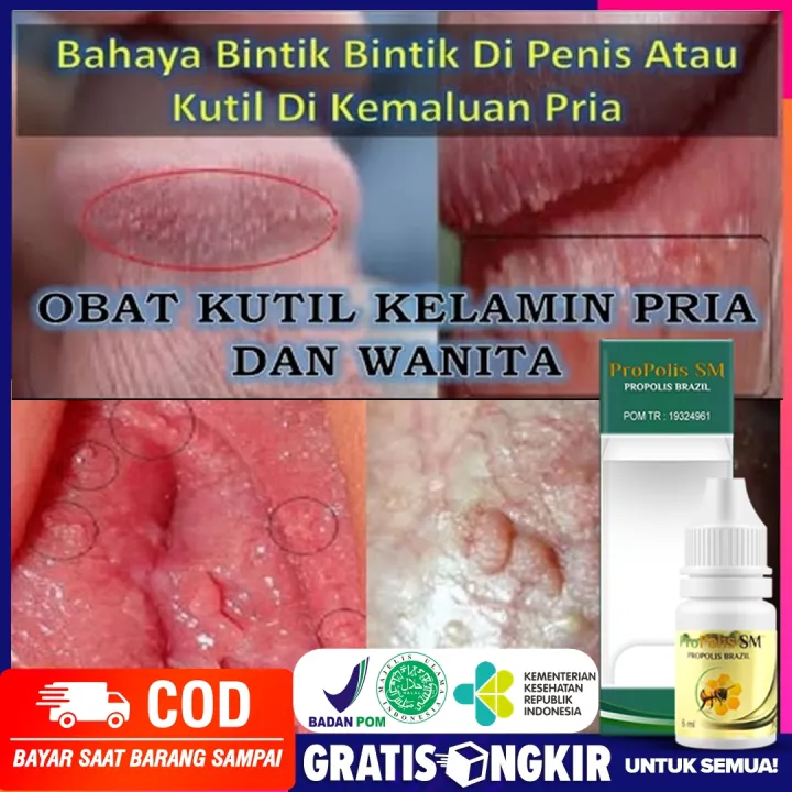 penyakit hpv laki laki