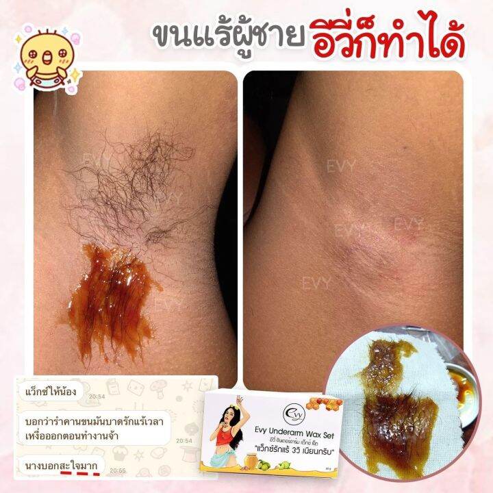 evy-wax-แว๊กซ์กำจัดขนรักแร้-ขา-บิกินี่-เรียบเนียนใน-3-วิ-1-ชุด