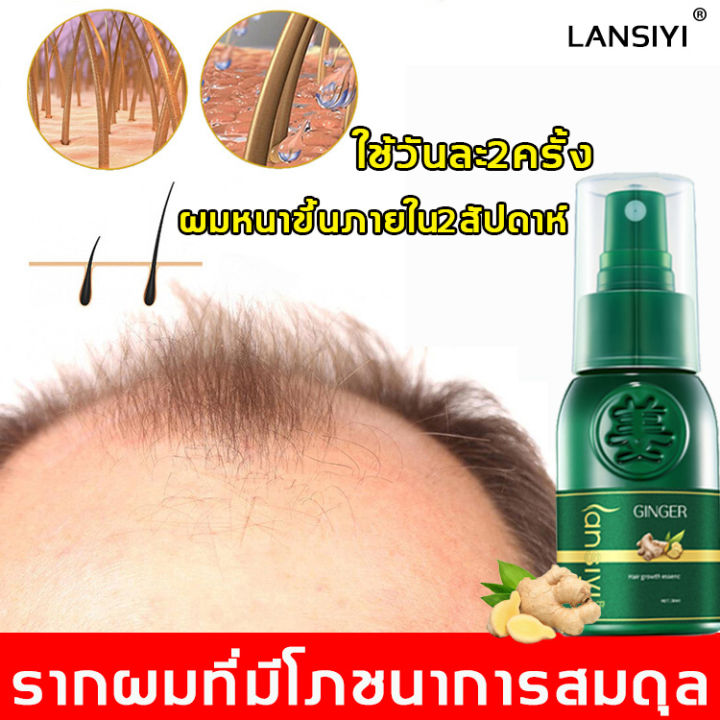 บอกลาหัวล้านlansiyi-น้ำยาปลูกผม-แก้ปัญหาผมร่วง-สเปรย์ปลูกผม-ป้องกันผมร่วง-สเปรย์ปปลูกผม-เซลั้มปลูกผม-เซรั่มปลูกผม-เร่งผมยาวไว-ปลูกผมเร่งด่วน-ยาปลูกผมของแท้-น้ำยาเร่งผมยาว-ครีมปลูกผม-เซรั่มเร่งผมยาว-เซ