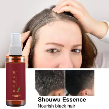 สเปรย์รักษาผมหงอก ราคาถูก ซื้อออนไลน์ที่ - ก.ค. 2023 | Lazada.co.th สเปรย์รักษาผมหงอก ราคาถูก ซื้อออนไลน์ที่ - ก.ค. 2023 | Lazada.Co.Th