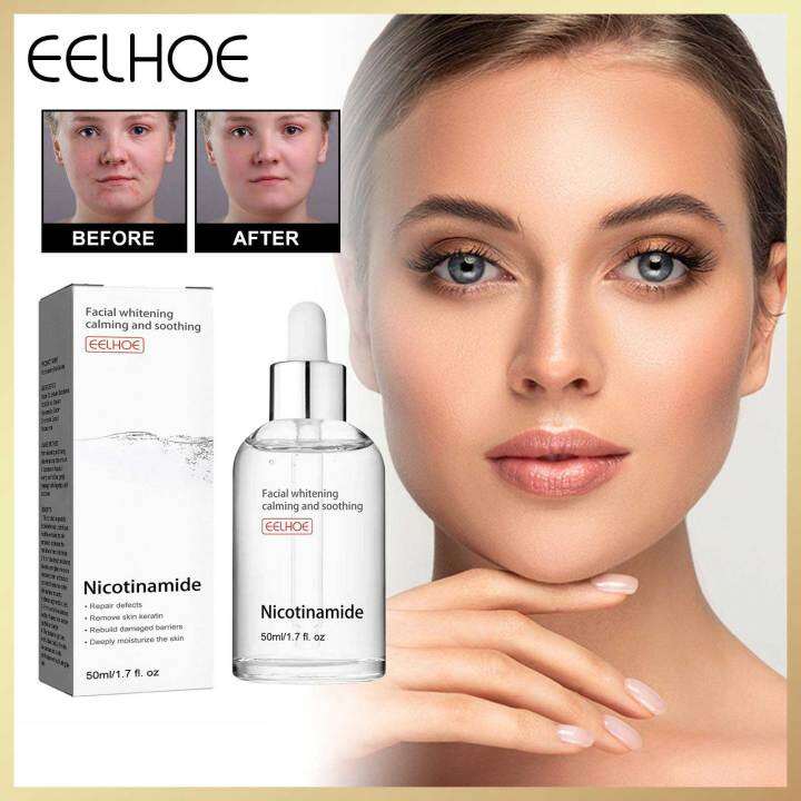 Eelhoe Nicotinamide Face Serum Dark Spot Whitening Acne Pimple ...