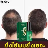 ?สินค้าขายดี? [แชมพู+นำ้ยา 30+300ml]ถูกที่สุด AOPY สเปรย์ปลูกผม เซรั่มปลูกผม  เร่งผมงอกใหม่ ป้องกันผมร่วง หัวล้าน ผมบาง ช่วยให้รากผมแข็งแรง,น้ำยาฉีดผม,เซรั่