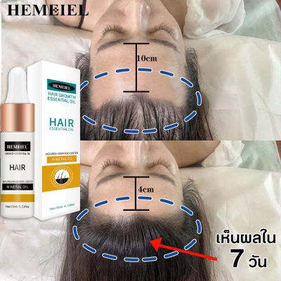 HEMEIEL  บำรุงผมยาวเร็ว/ ยาปลูกผมของแท้ /ครีมเร่งผมยาว/ช่วยปรับปรุงผมร่วง /เร่งผมยาว