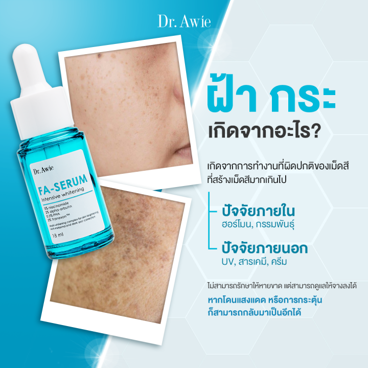 dr-awie-fa-serum-เซรั่มขวดฟ้า-แก้-ฝ้า-3-ขวด-54-ml-แก้ฝ้า-กระ-จุด-ด่าง-ดำ-รอย-สิว-รอย-ดำ-จาก-สิว-เซรั่ม-ขวดฟ้า