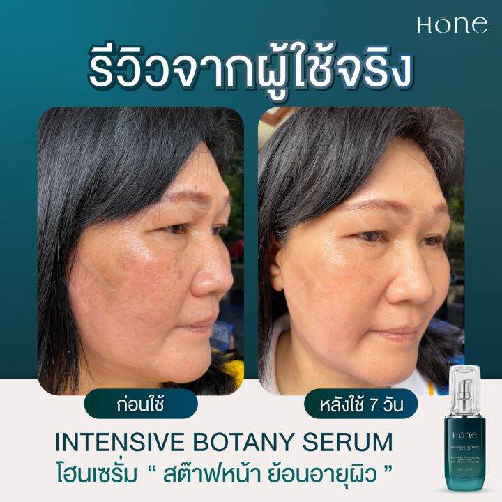 ส่งฟรี-ของแท้-โฮนเซรั่ม-เซรั่มหนุ่มกรรชัย-hone-intensive-botany-serum-ไฮยาฟิลเลอร์-โบท็อกซ์-เซรั่มผิวหน้า-ยกกระชับ-เติมความชุ่มชื่น-ลดร่อง-ริ้วรอย