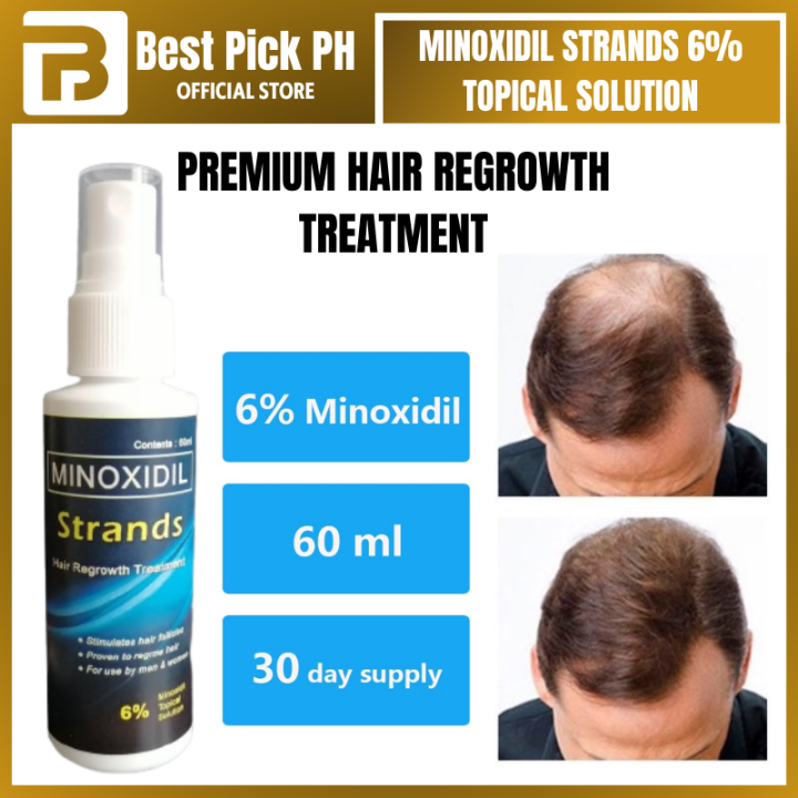 Premium Quality Minoxidil Strands 6% Minoxidil Premium Hair Grower ...