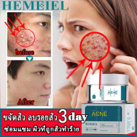 HEMEIEL ครีมลดสิว/เซรั่มไฮยา/เซรั่มลดสิว