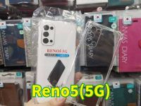 (พร้อม​ส่งในไทย)เคสใสกันกระแทกแบบคลุมกล้องOPPO Reno5(5G)