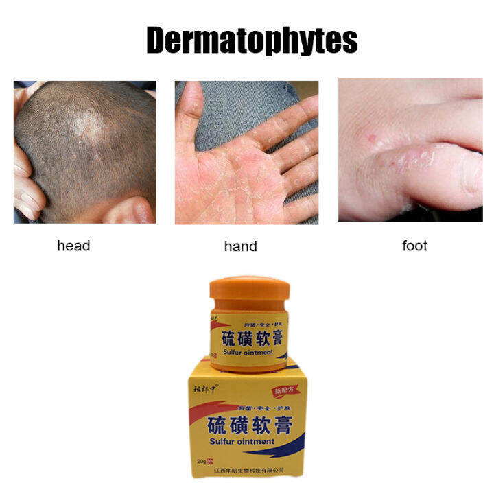 Chinese Herbs Sulfur Antibacterial Skin Cream Effectively Soften