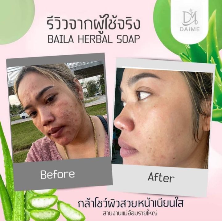 สบู่ไบล่า-เอิร์นไดเม่-baila-herbal-soap-ขนาด-30-กรัม