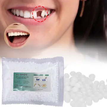 Shop moldable false teeth for Sale on Shopee Philippines