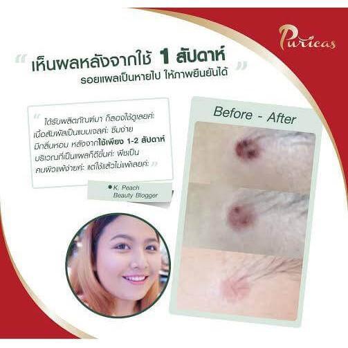 เพียวริก้าส์-ดราก้อนบลัด-ลดรอย-puricas-dragons-blood-scar-gel-3-g