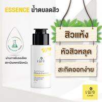 เฌอ ? Essence น้ำตบ สิวยุบไว รอยจางไว Cher Skincare