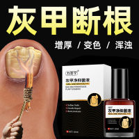 การรักษา Lecning Onychomycosis Liquid กำจัดเล็บที่ไม่ดีและเล็บหนา