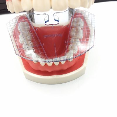 1Pcs Dental Lab Dental Guide Plate Teeth Arrangement On Denture Dental Supply