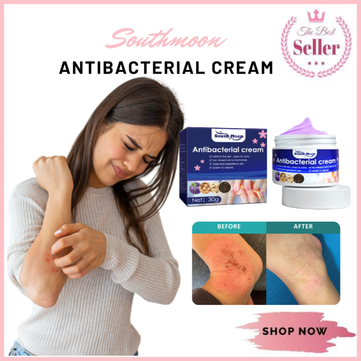 100 Effective Antibacterial Cream 30g Skin Rash Cream Skin Herbal Psoriasis Dermatitis Eczema