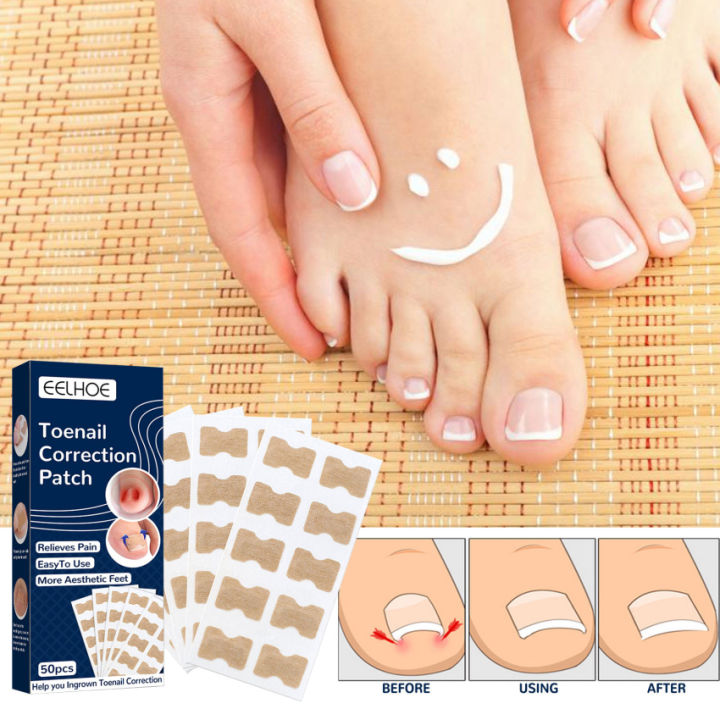 50pcs-nail-correction-stickers-ingrown-toenail-pedicure-tools-patches-waterproof-recover-corrector-toenail-elastic-health-care100-brand-new-and-high-qualitycapacity-50pcs-one-sheet-has-10pcs-function-