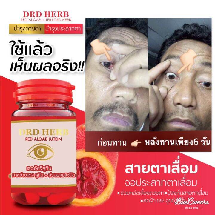 ส่งฟรี-ดีอาร์ดี-เรดอัลจีลูทีน-drd-red-algae-lutein-สาหร่ายแดงลูทีน-และส่วนผสม-8-ชนิด-บำรุงสายตา-ประสาท-ตาแห้ง-แสบตา-ต้อกระจก-1-กระปุก-30-แคปซูล