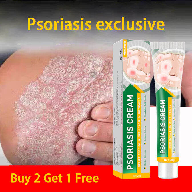 Antiitching and antibacterial cream skin moss removal topical use