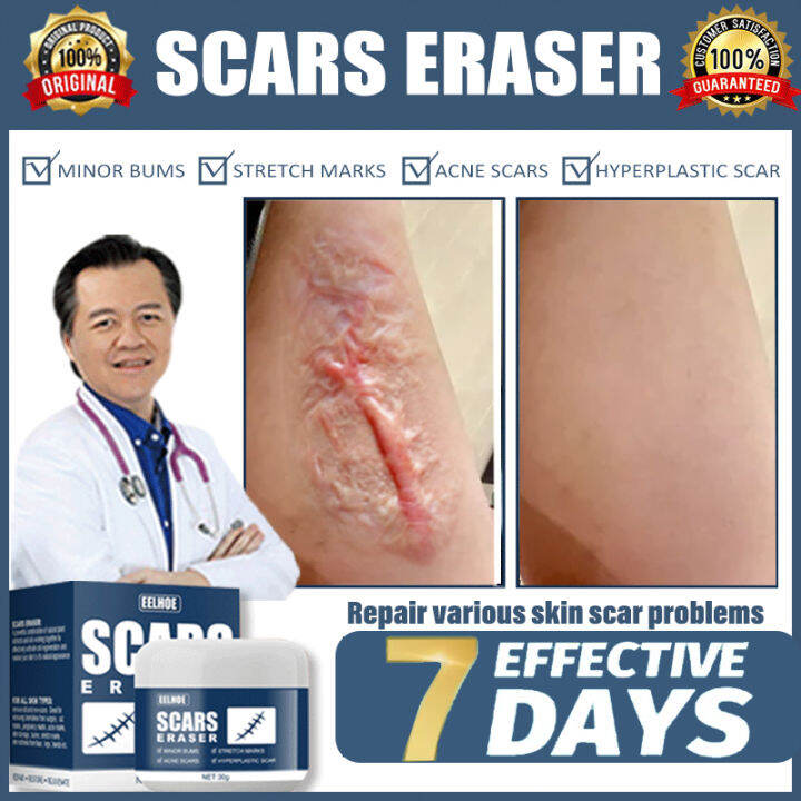 fix scar removal original scars remover for old scars scar gel by doc