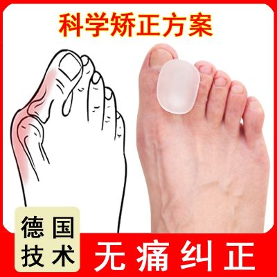 Germany jie wo thumb eversion overlap wear cloven foot orthotics toes rectifiers separator breathe freely