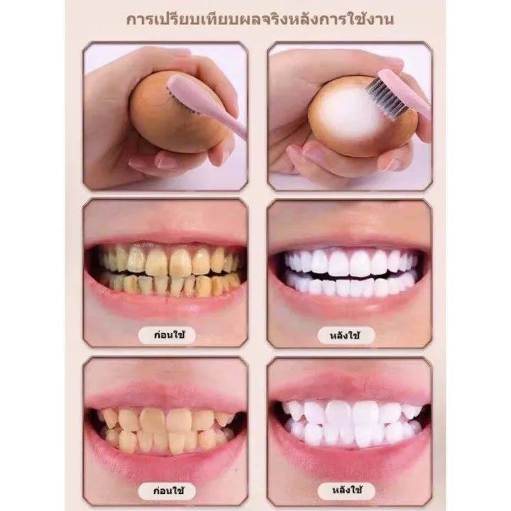 บอกลาฟันเหลือง-vshell-ยาสีฟันฟันขาว-น้ำยาขัดฟันขาว-ฟอกฟันขาว-ฟันขาว-ยาสีฟันฟอกขาว-ยาสีฟันขาว-ฟอกสีฟันขาว-ฟันเหลือง-น้ำยาฟอกฟันขาว-แก้ฟันเหลือง-ที่ขัดฟันขาว-ฟันขาว-ฟอกสีฟัน-ยาสีฟันขจัดปูน-ยาฟอกฟันขาว-ย