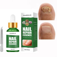 30ML Nail Fungal Treatment Feet Care Essence Nail Foot Toe Nail Fungus Removal Gel Anti Infection Paronychia Onychomycosis