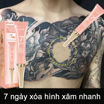 Xóa Hình Xăm Không Đau Không Để Lại Sẹo Tại TPHCM - Spa Xóa Hình Xăm