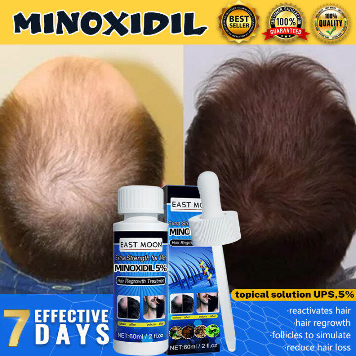 Strands Minoxidil 6% Solo Hair Grower Beardgrower for Men & Women (60ml ...