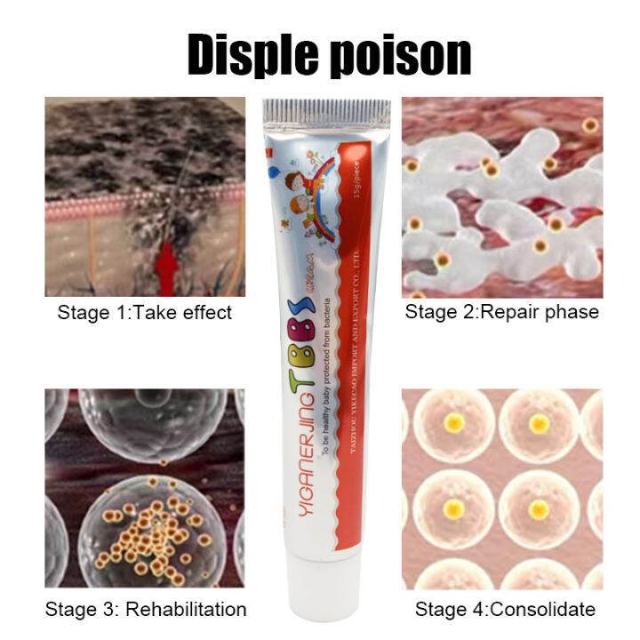 Original Eczema Psoriasis Treatment Cream Chinese Traditional Herbs