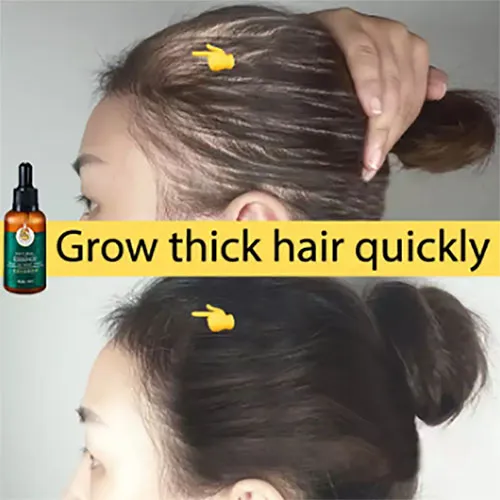 Hair Growth Spray Hair Essential Oils For Hair Growth Care Essential Oil Hair Growth Fluid Essential Hair Growth Spray Hair Essential Oils For Hair Growth Care Essential Oil Hair Growth Fluid Essential
