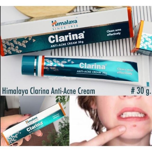 ถูกชัวร์-himalaya-clarina-30-กรัม-ครีมทาสิวกล่องเขียวสูตรเข้มข้น-ทาสิวอักเสบ-ของแท้-มีเก็บเงินปลายทาง