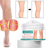 VOVA Varicose Veins Ointment Effective Treatment Vasculitis Medical Treatment Spider Plaster Herbal Leg Health Cream Body Care