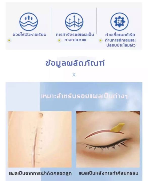 ครีมลดแผลเป็น-ครีมทาแผลเป็น-ลดรอยแผลเปน-แผลไฟไหม้-น้ำร้อนลวก-ซ่อมแซมผิวที่เสียหาย-ลดรอยแผลเปน-ลดรอยเเผลเป็น-ครีมลดรอยแผลเป็น-ครีมลดรอยแผลเป็-น้ำลดรอยแผลเป็น-ครีมทาแผลเป็น-ลดรอยแผลเปน-แผ่นแปะแผลเป็น