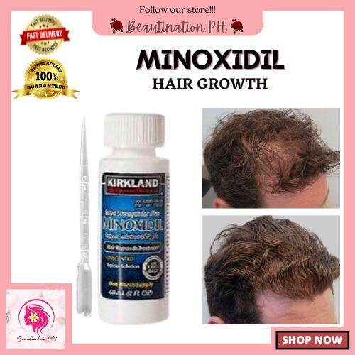 Minoxidil For Men And Women, Extra Strength Hair Regrowth Treatment, Is ...