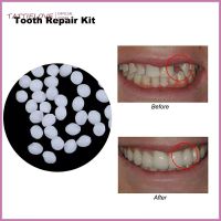 Tattielove-10g/100g denture solid glue temporary tooth restoration dental restoration kit oral care tool