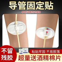 Medical catheter fixed sticker drainage tube abdominal penetrating nasal body surface bile duct gluer