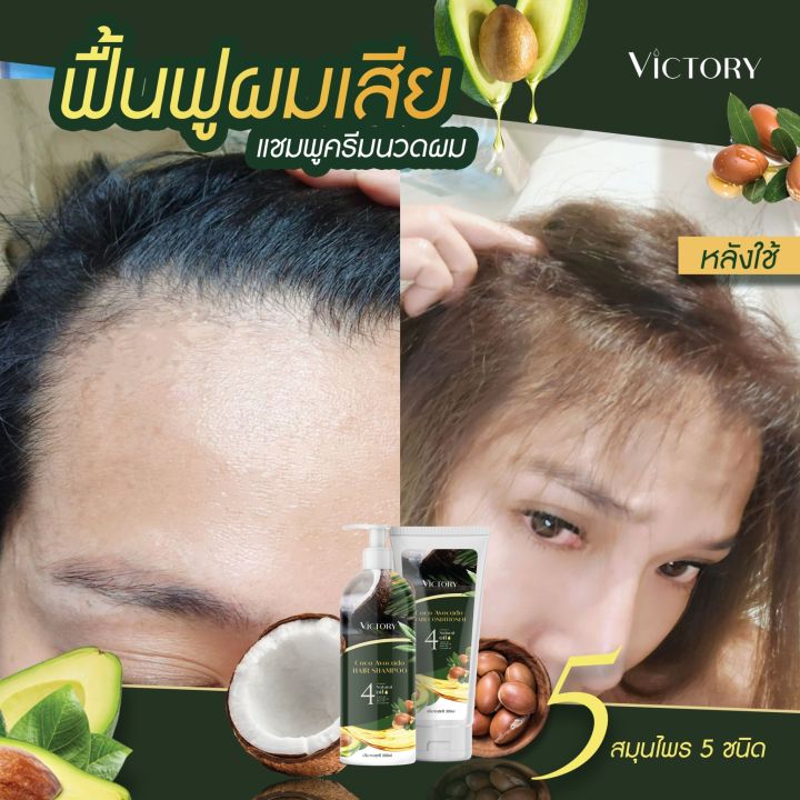 ชื้อ1ฟรี-1-เซรั่ม-วิคตอรี่-victory-hair-shampoo-เซรั่มป้องกันผมขาดหลุดร่วง-ผมแห้งเสีย-ผมแตกปลาย-1-แถม-1