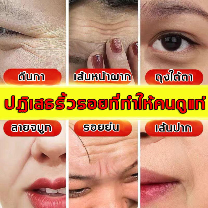 retinol-cream-ครีมต่อต้านวัย-ครีมลดริ้วรอย-ครีมเรตินอลแท้-ครีมทาผิวขาว-ครีมบำรุงหน้า-กระชับ-ยกกระชับ-ครีมยกกัชับ-ให้เต่งตึง-หน้าเรียบเนียน-30g