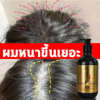 แชมพูแก้ผมร่วง 500ML แชมพูปลูกผมดก แชมพูขิงเพียว เร่งผมเกิดใหม่ ยับยั้งรังแค สดชื่น ควบคุมความมัน ป้องกันผมร่วงบำรุงผม ขิงบำรุงถึงราก