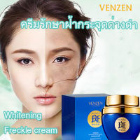 （กำ​จัด​ฝ้า​กระ​ใน​ 7​ วัน​)VENZEN Freckle Cream ครีมทาฝ้ากระ ครีมบำรุงหน้า ครีมหน้าขาวใส ลดฝ้ากระ ครีมทาหน้าขาว ครีมแก้ฝ้ากระ ครีมทาฝ้าลึก whitening cream 50gดูแลผิวให้ขาว ลดเม็ดสีเมลานิน ครีมรักษาฝ้า ครีมไวเทนนิ่ง-7477