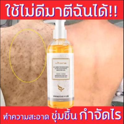 HYQING shower gel 260ML ครีมอาบน้ำกำจัดไร เจลอาบน้ำ สบู่อาบน้ำครีมอาบน้ำ ครีมอาบน้ำขาว สบู่อาบน้ำครีมอาบน้ำ ป้องกันผิวแห้ง