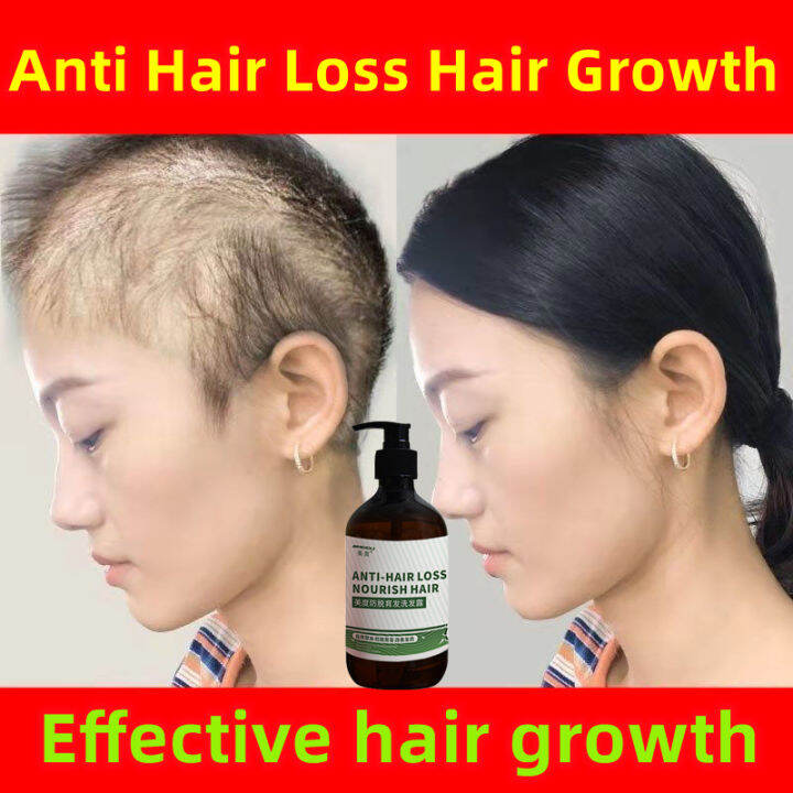 【Spot goods】100 Herbal Hair Growth Shampoo Conditioner Continuously