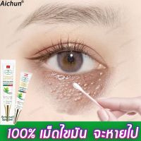 Aichun30ml(ลดถุงใต้ตา, เม็ดไขมัน, ครีมทาใต้ตาดำ，ครีมบำรุงรอบตา อายครีมบำรุงตา,ดูแลรอบดวงตา，กระชับรอยตีนกาครีมบำรุงใต้ตา)