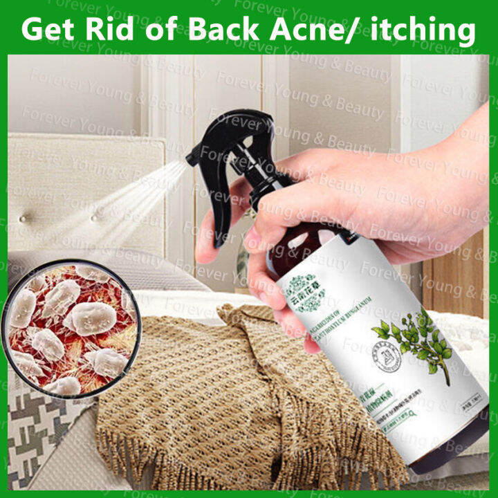 320ML Mite Spray Bed Bug Killer Insect Spray Dust Mite Remove Spray