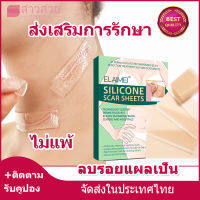 【หุ้นที่มีอยู่】แผ่นแปะแผลเป็น 4pcs ซ่อมแซมรอยแตกลาย แผลผ่าตัด แผลผ่าตัดหลังคลอด สติกเกอร์ความงาม