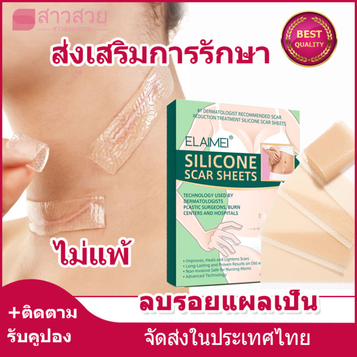 หุ้นที่มีอยู่-แผ่นแปะแผลเป็น-4pcs-ซ่อมแซมรอยแตกลาย-แผลผ่าตัด-แผลผ่าตัดหลังคลอด-สติกเกอร์ความงาม