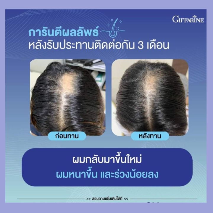 กิฟฟารีน-ผมร่วง-ไบโอติน-เอช-พลัส-biotin-h-plus-อาหารเสริมสุขภาพ