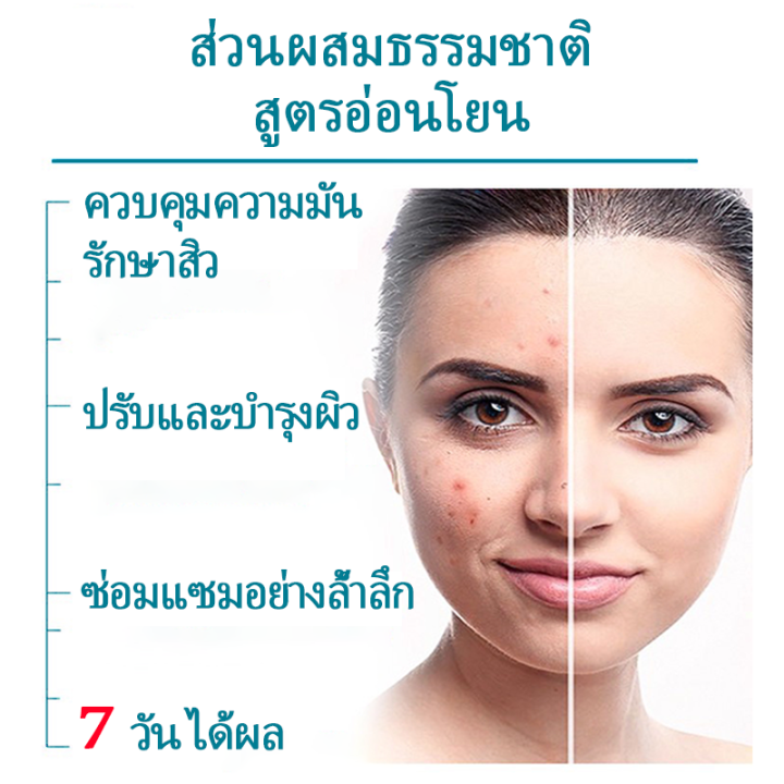 hemeiel-เจลผักลดสิว-กำจัดสิวอย่างมีประสิทธิภาพ-เจลแต้มสิว-สำหรับสิวอักเสบ